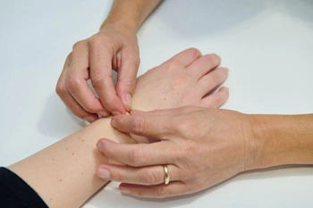 Trattamento manuale della cicatrice
