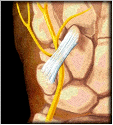 CanaleDiGuyon - Fig.3