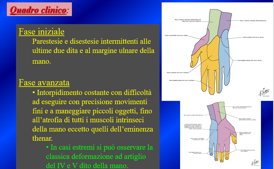 NervoUlnareGomito - Fig.3
