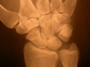 articolazione mano 2