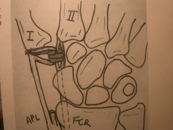 articolazione mano 4