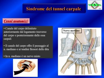 Tunnel Carpale - Fig.2